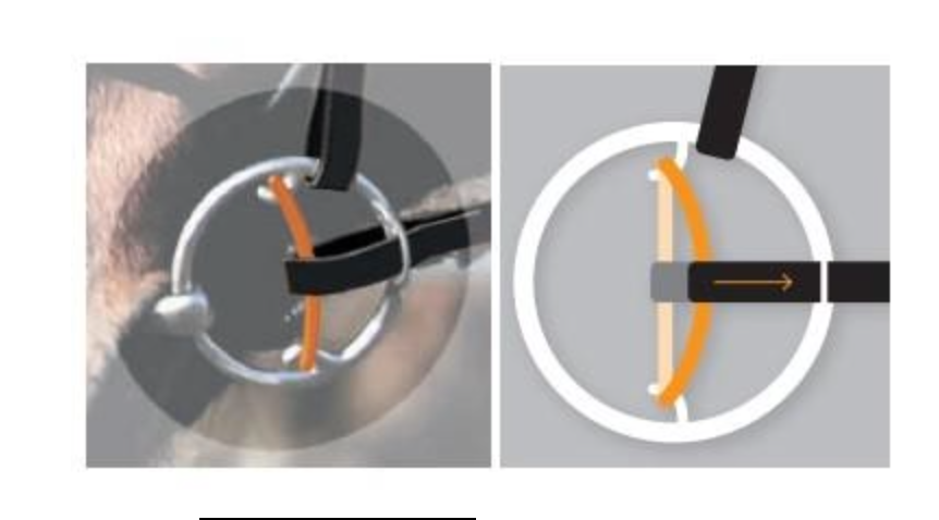 Bocado Bucephalus EZ Control